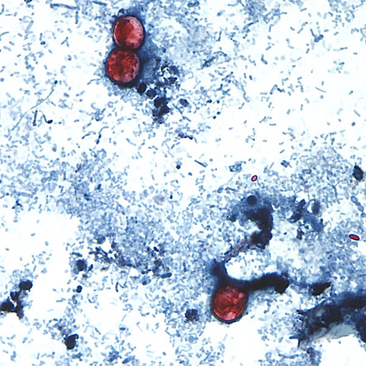 Surto de parasita ligado a alfaces soma mais de 2,8 mil casos de ciclosporíase nos Estados Unidos - Imagem do artigo